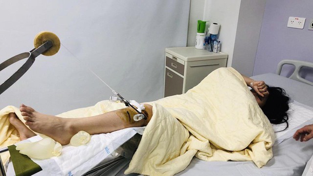 Tâm sự nghẹn ngào của người bố có con gái bị xe sang đâm nguy kịch rồi bỏ chạy