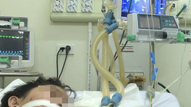 Nhiều lo ngại khi bệnh viêm não mô cầu có xu hướng gia tăng trong dịp Hè