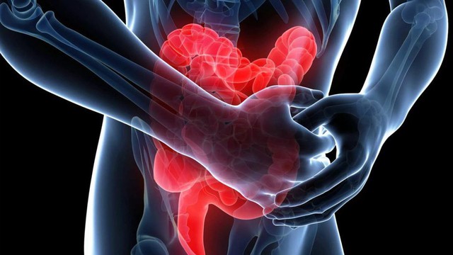 5 dấu hiệu của bệnh viêm trực tràng: Không điều trị sẽ có nguy cơ tiến triển thành ung thư