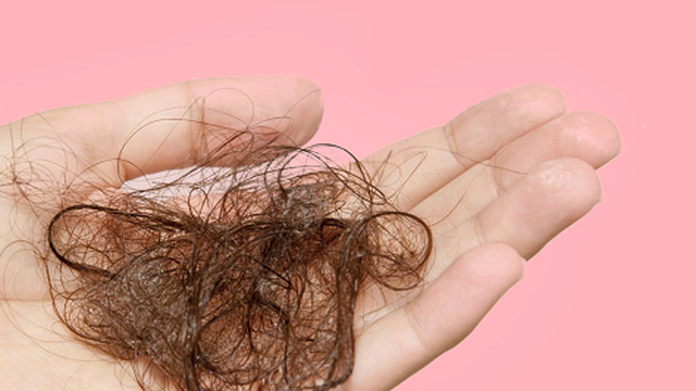 Top 3 cách trị rụng tóc hiệu quả cực nhanh, áp dụng được cho cả nam và nữ