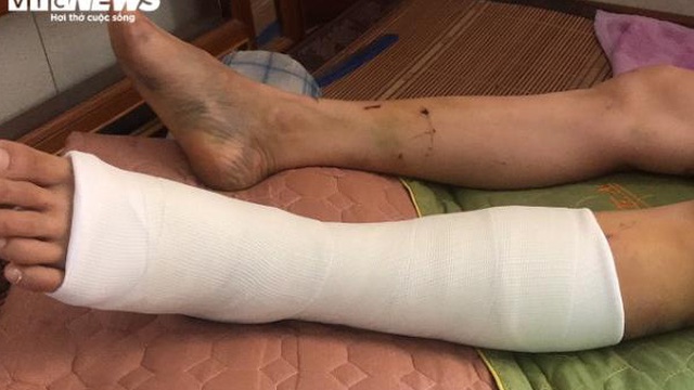 Trưởng Ban Nội chính Thái Bình gây tai nạn rồi bỏ trốn: Lời kể người thoát chết