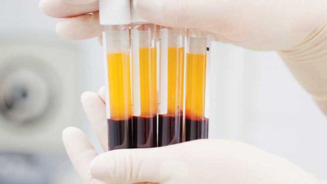 Covid-19: Hai người bệnh nặng hồi phục sau khi điều trị bằng huyết tương
