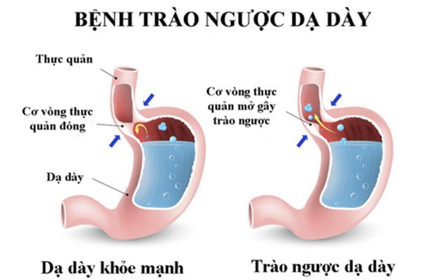 Thuốc hay chữa bệnh từ cây quít