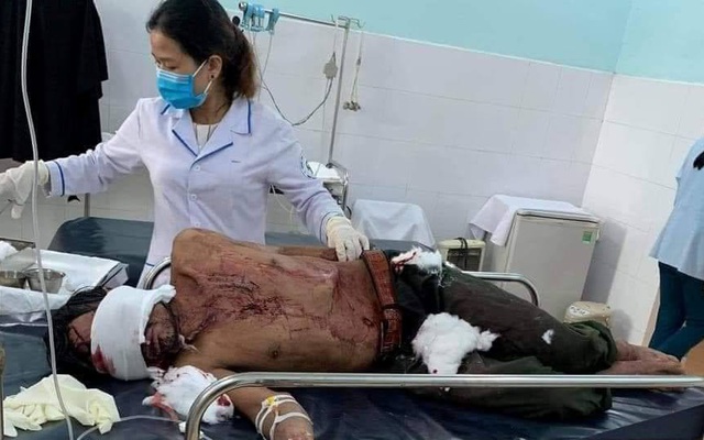 Tin mới vụ người đàn ông bị gấu rừng tấn công ở Quảng Nam