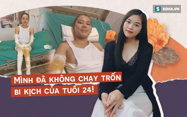 Cô gái xinh đẹp và sự cố bỏng kinh hoàng ngày khai trường: "Mình đã sống lại trên đường tìm đến cái chết!"