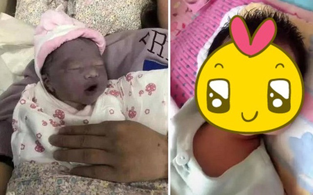 Mẹ muốn khóc khi con gái mới sinh trông như "củ khoai môn", 3 tháng sau bé có pha thay đổi ngoại hình khiến ai cũng ngỡ ngàng