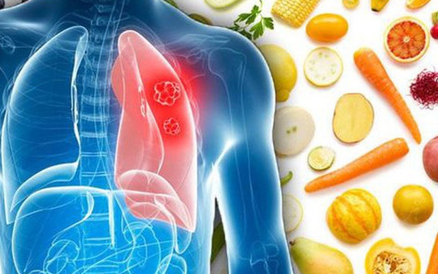 8 thực phẩm người bệnh ung thư phổi nên ăn thường xuyên