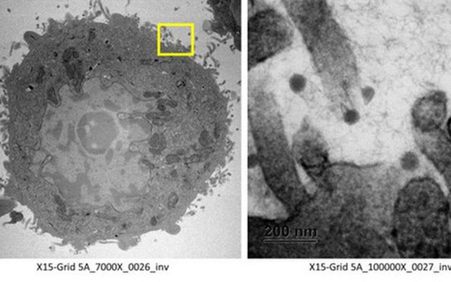 Càng nhiều người nhiễm SARS-CoV-2, virus càng có cơ hội biến chủng