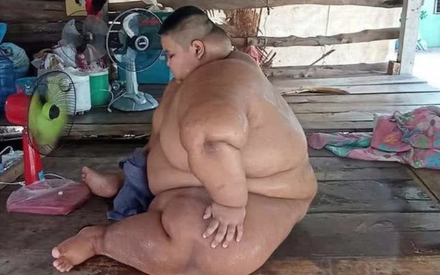 Bi kịch của cậu bé béo nhất Thái Lan: 13 tuổi đã nặng 200kg, từ bé bị ép ăn cho “chóng lớn” và hậu quả đáng thương gây ám ảnh