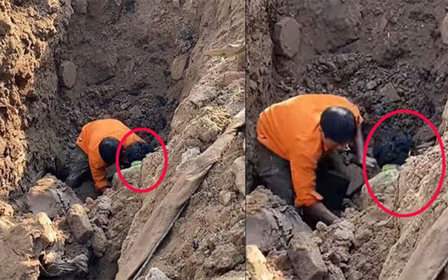 Sức khỏe người đàn ông "đào được dưới hố sâu 2 m" ra sao?