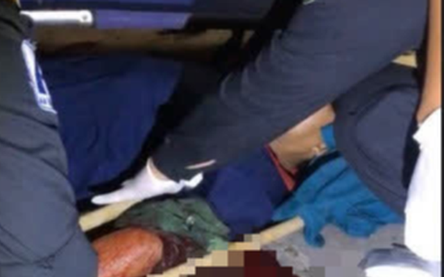 Kinh hãi nam công nhân bị chém gần lìa cánh tay trong KCN Long Thành