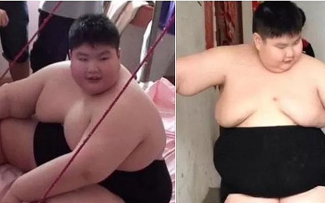 14 tuổi nặng 180 kg, cậu nhóc ăn gấp 7 lần người bình thường, phụ huynh phải lên YouTube cầu viện ''cứu trợ''