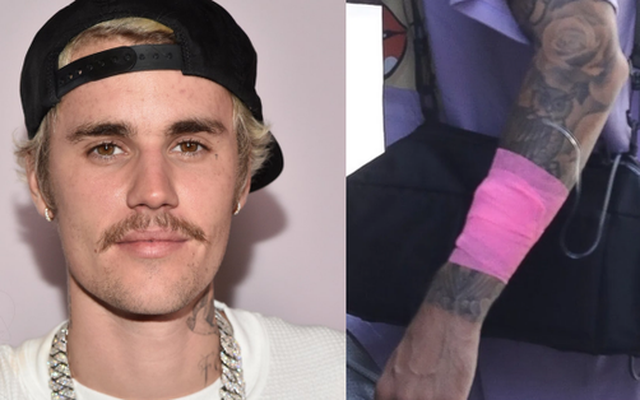 Justin Bieber hé lộ lý do xuống sắc không phanh gần đây: Mắc bệnh hiếm gặp ảnh hưởng đến não!