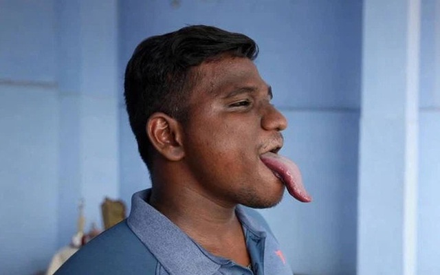 Chàng trai có lưỡi dài gấp 4 lần người thường, biết làm đủ trò độc dị nên được ghi danh vào sách kỷ lục Guinness