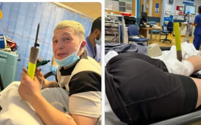 Kinh dị VĐV bị cột cờ đâm thủng đầu gối, nhưng thần thái tưng tửng của anh chàng còn đáng chú ý hơn