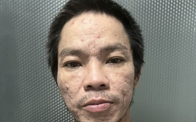 Phá đường dây ma túy của đại ca Hải “mặt rỗ”