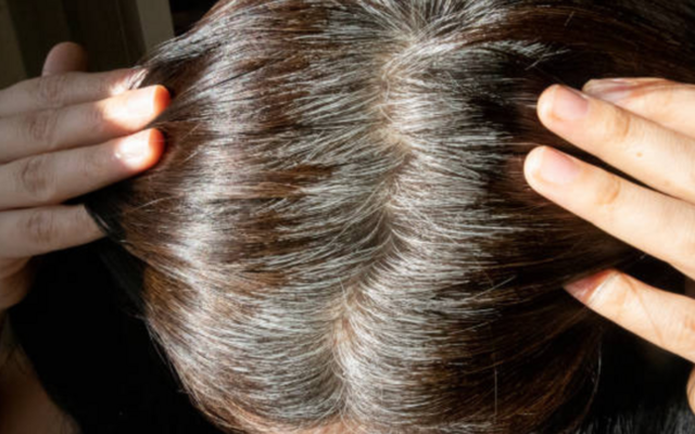 Mẹo tuyệt vời giúp bạn chống lại tình trạng tóc bạc sớm