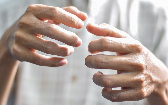 Bàn tay có thể dự báo bệnh tật: 4 dấu hiệu bất thường ở tay cảnh báo tim, gan suy yếu, ung thư ‘tìm đến’