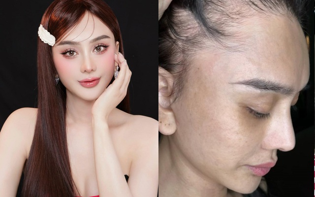 Netizen xót xa trước mặt mộc, rụng tóc hói đầu của Lâm Khánh Chi ở tuổi 45