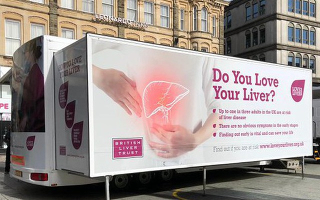 Sáng kiến xe tải di động tầm soát ung thư gan tại Anh