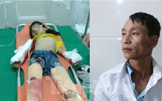 Nỗi đau của người bố có 3 con nhỏ nguy kịch sau vụ nổ kinh hoàng tại gara ô tô ở Nghệ An