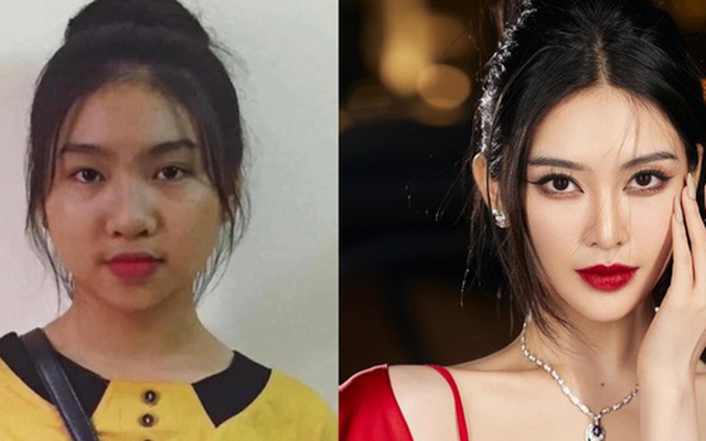 Lan truyền hình ảnh trước khi phẫu thuật thẩm mỹ của “bản sao Phạm Băng Băng”