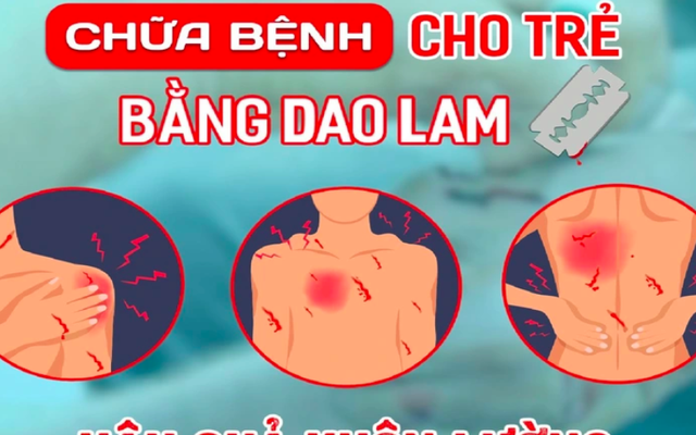 Bé trai tử vong sau khi người nhà đưa đi chữa mẹo, dùng dao lam rạch da để thải máu độc