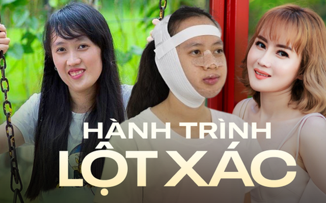 Cô giáo Bến Tre trải qua đại phẫu 11 tiếng để khắc phục "mặt vặn xoắn", cuộc sống hiện tại giống như "phép màu"