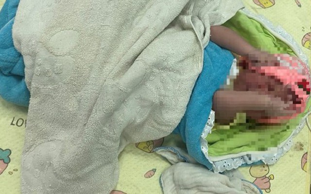 Bé trai chưa được cắt rốn bị bỏ lại ở Bệnh viện Đa khoa tỉnh Quảng Trị