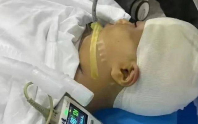 Nữ sinh lớp 4 bị thầy giáo dùng thước "tác động vật lý" đến mức vỡ hộp sọ, thái độ của "hung thủ" sau đó càng gây phẫn nộ hơn