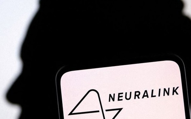 Tỷ phú Elon Musk: Bệnh nhân được cấy chip não có thể điều khiển chuột máy tính bằng suy nghĩ