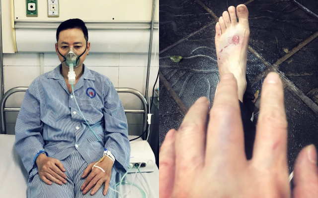 Nam diễn viên Việt gặp chuyện hi hữu: Vừa ra viện thì bị tai nạn, lại vào viện