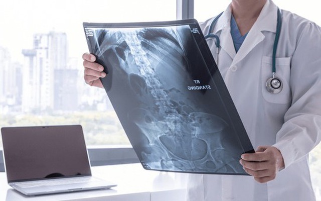 Xem ảnh chụp X-quang của bệnh nhân bị đau bụng, bác sĩ sốc nặng khi nhìn thấy thứ trong ổ bụng