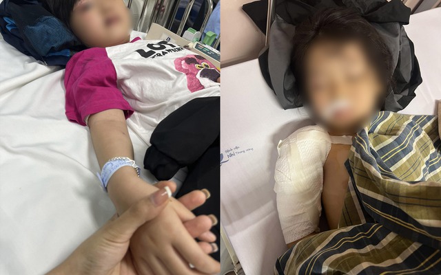 Vụ bé gái 5 tuổi ở Hà Giang bị chó cắn nhập viện: Con chó có nhiều "dấu hiệu không bình thường"