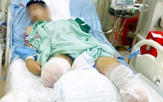 Xót xa gia cảnh của nam sinh bị tai nạn tàu hỏa phải cắt bỏ đôi chân trước kỳ thi tốt nghiệp THPT