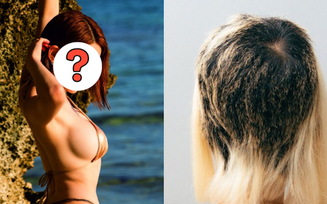 Nữ DJ suy sụp bật khóc, tóc rụng mảng lớn