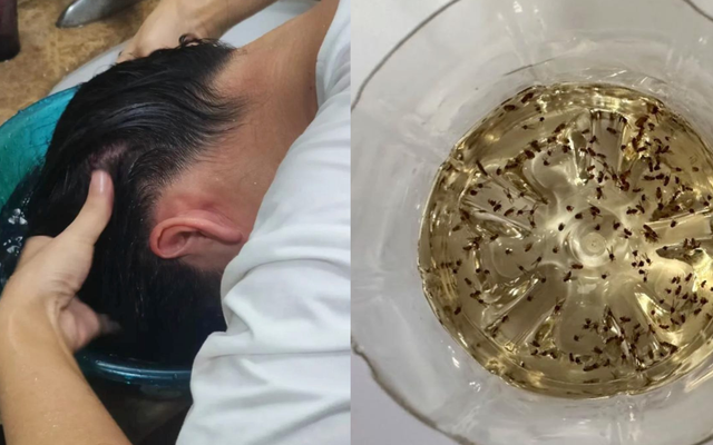 Lần đầu tiên sau 40 năm cuộc đời phát hiện: 9 sự "bá đạo" của giấm trắng