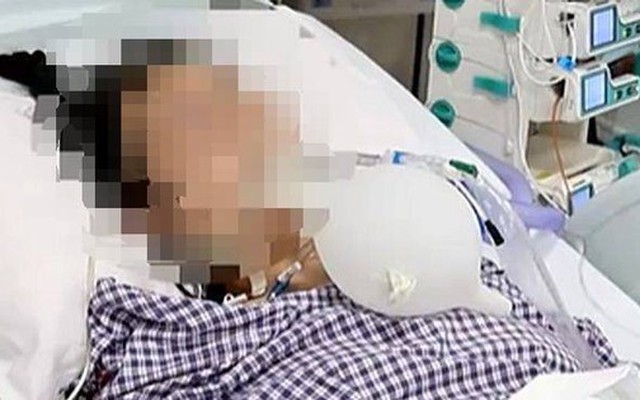 Người phụ nữ nguy kịch, suy hô hấp sau khi làm 1 việc để xóa nếp nhăn