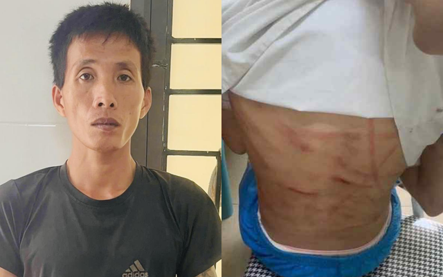 Lời khai của Nguyễn Văn Nam - gã cha dượng đánh đập bé gái lớp 5 dã man