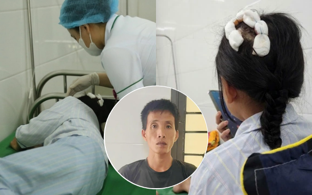 Sức khỏe của bé gái bị cha dượng dùng búa đánh vào đầu hiện ra sao?