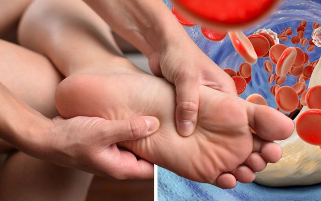 5 loại thực phẩm có thể đào thải axit uric nhanh chóng, bảo vệ thận: Toàn loại dễ kiếm