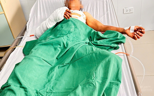 Công an thông tin vụ đôi nam nữ bị truy sát trong phòng trọ