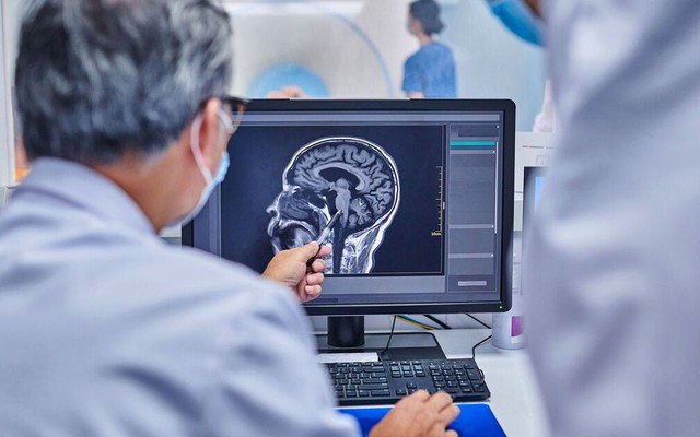 Cảnh báo: Nguy cơ đột quỵ tăng 86% ở những người có đặc điểm này ở miệng