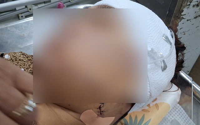 Nghi vấn nữ cán bộ xã ở Đồng Tháp rạch mặt người phụ nữ nhậu với chồng