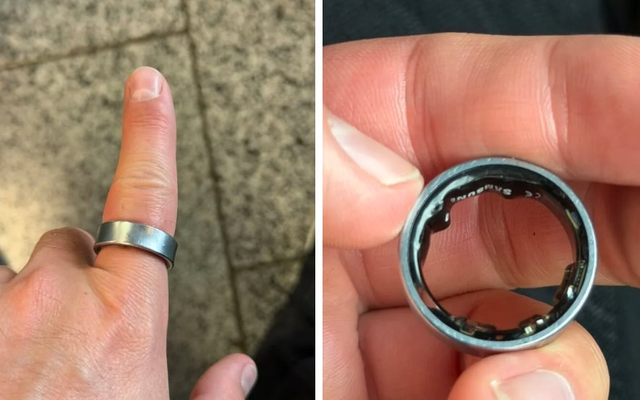 Người dùng hốt hoảng khi một sản phẩm của Samsung phồng pin, kẹt luôn trên ngón tay: "Vừa đau vừa sợ nổ"