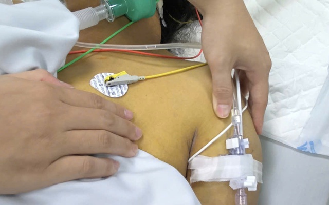 Toàn thân vàng như nghệ, suy đa tạng chỉ trong 24 giờ: Bác sĩ Hồi sức tích cực cảnh báo ‘tử thần’ mùa mưa