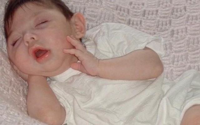 Cô bé sinh ra không có não bây giờ ra sao?