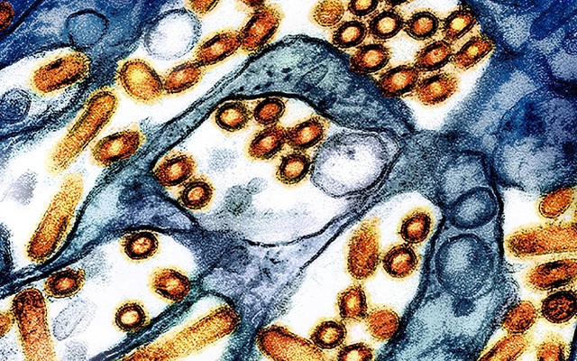Phát hiện chủng virus cúm gia cầm chưa từng thấy ở người tại Mỹ