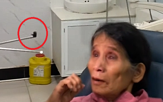 Ớn lạnh cảnh con đỉa sống trong mũi người phụ nữ suốt 3 tuần