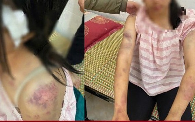 Ba kẻ tra tấn cháu gái suốt 4 giờ có thể bị khởi tố thêm nhiều tội danh